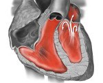 Малая аномалия сердца код по мкб 10 у детей thumbnail