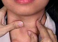 Диагноз щитовидной железы код мкб thumbnail