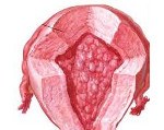 Атипичная гиперплазия эндометрия код по мкб 10 thumbnail