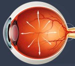 H40.1 Первичная открытоугольная глаукома