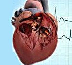 Код мкб код хроническое легочное сердце thumbnail