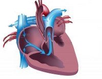 Синдром гипоплазии левых отделов сердца по мкб 10 thumbnail