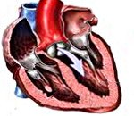Аортальный порок сердца код мкб thumbnail