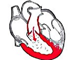 Дисфункция клапана легочной артерии код по мкб thumbnail