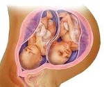 Код многоплодной беременности по мкб thumbnail