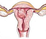 Плацентарный полип после родов код мкб thumbnail