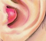 Фурункул наружного слухового проход код мкб thumbnail