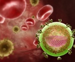 B22.0 Болезнь, вызванная ВИЧ, с проявлениями энцефалопатии