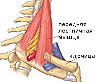 Синдром передней лестничной мышцы мкб thumbnail