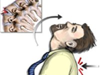 Код мкб травматическая болезнь спинного мозга thumbnail