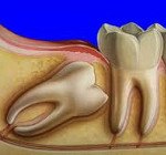 Код мкб хирургическая стоматология thumbnail