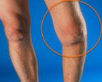 Анкилоз коленного сустава код мкб thumbnail