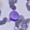 Анализ крови на клеточном уровне thumbnail