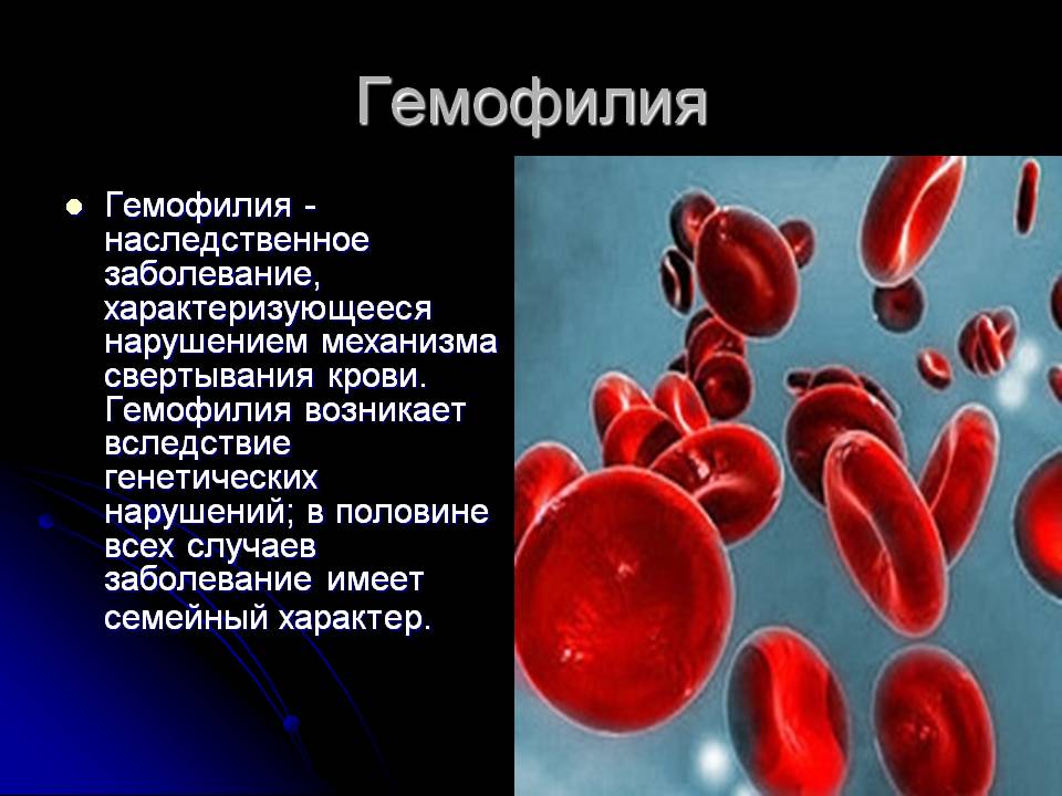 Гемофилия код мкб 10 thumbnail