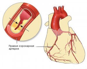 Кровоснабжение сердечной мышцы