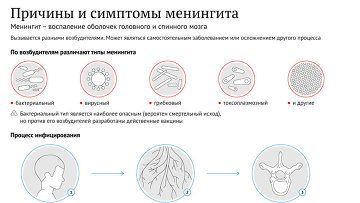 Симптомы и причины менингита