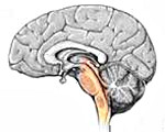 C71.7 Злокачественные новообразования ствола мозга