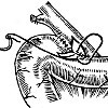 Анастомоз желчного пузыря с желудком thumbnail