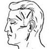 Operations on soft tissues of the face and neck