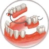 Removable prosthetics of teeth