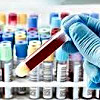 Comprehensive laboratory tests