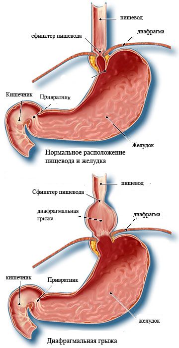 Клапан пищевода и желудка. Кардиальный клапан желудка. Кардиальный сфинктер пищевода.