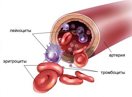 Гемобластозы - опухоли, развивающиеся из клеток кроветворной ткани