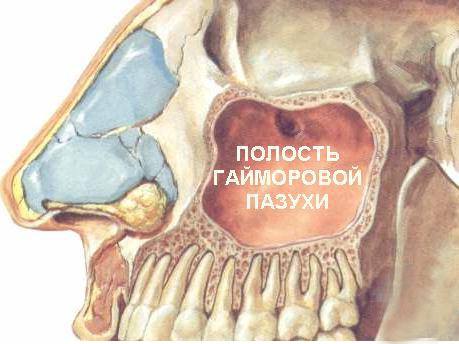 Анатомическое расположение гайморовой пазухи